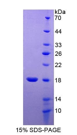 Human RCBTB2 Protein (Recombinant His-S)