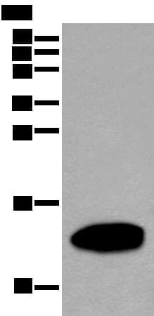 Polyclonal Rabbit anti-Human REG1A Antibody (WB)
