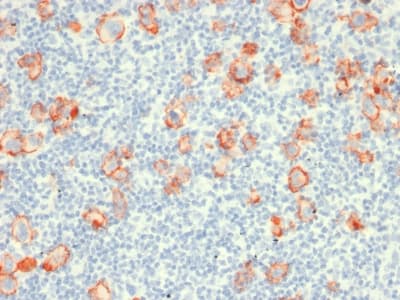 Recombinant Monoclonal Mouse anti-Human CD30 Antibody (clone rCD30/412, Azide-free,Carrier-free, IHC)