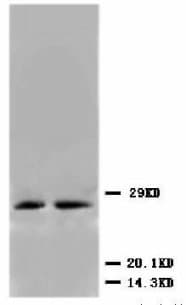 CDKN1B / p27 Kip1 Antibody (C-Terminus)