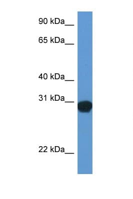 Polyclonal Rabbit anti-Rat SNAP29 Antibody (aa110-159, WB)