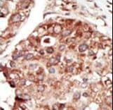 PEBP1 / RKIP Antibody (aa137-167)