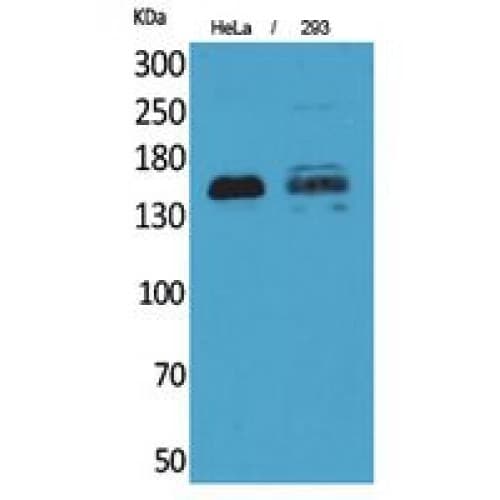 PTPRJ / CD148 Antibody (861-910 aa, Internal)