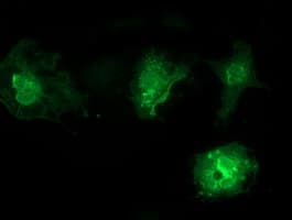 Monoclonal Mouse anti-Human VSIG2 Antibody (clone OTI2D8, IHC, IF, WB)