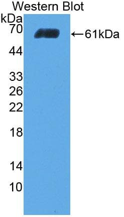 COL1A2 / Collagen I Alpha 2 Antibody (aa1057-1339)