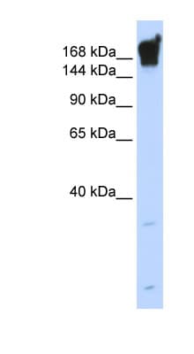 Polyclonal Rabbit anti-Human Dysferlin Antibody (aa1296-1345, IHC, WB)