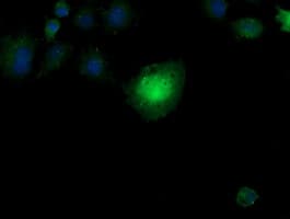 CCT8L2 Antibody (clone OTI1C1)