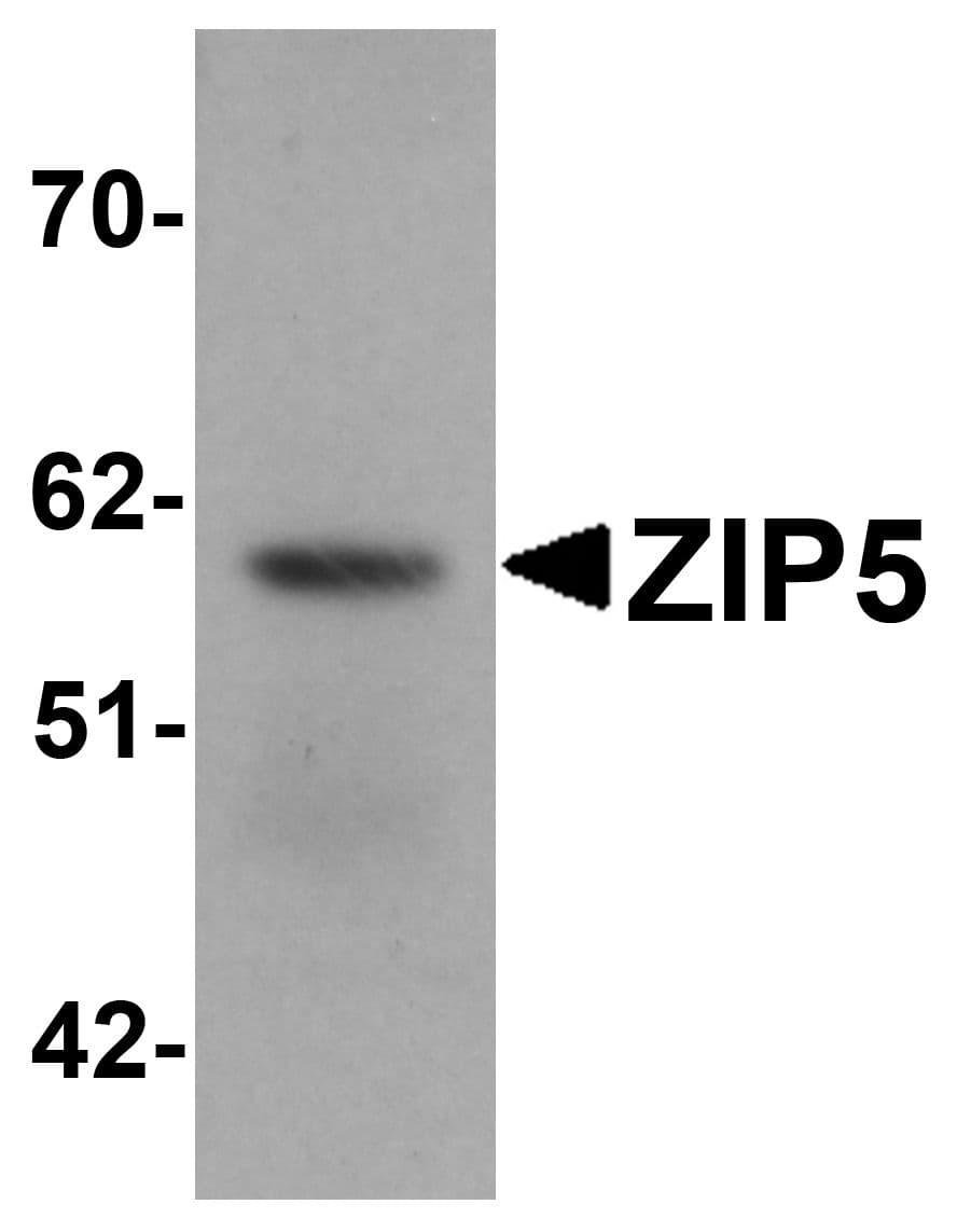 SLC39A5 / ZIP5 Antibody