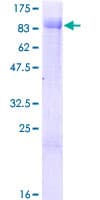 Human ZBTB46 Protein (Recombinant GST)