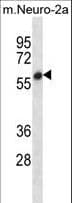 SMYD2 Antibody (aa120-152)