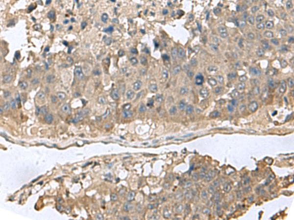 GABARAPL2 / ATG8 Antibody