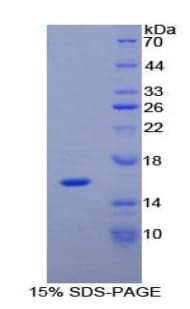 Rat IL16 Protein (Recombinant His-T7)