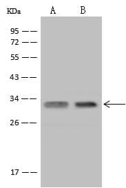 Polyclonal Rabbit anti-Human USE1 / p31 Antibody (IHC, IF, WB)