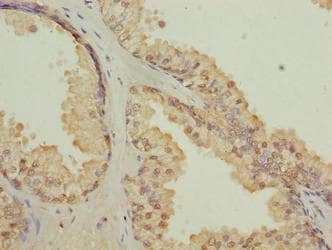 Polyclonal Rabbit anti-Human CGGBP1 Antibody (IHC)