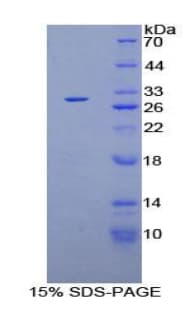 Rat CSNK1A1 / CK1 Alpha Protein (Recombinant His-T7)