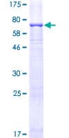 Human MAPK3 / ERK1 Protein (Recombinant GST)