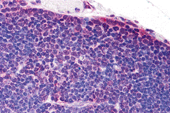 Polyclonal Rabbit anti-Human TLR8 Antibody (IHC)