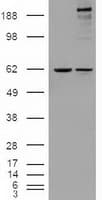NOTCH1 Antibody (clone OTI4C9)