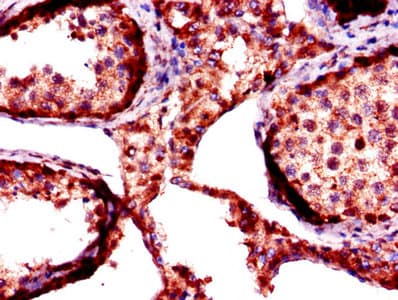 Polyclonal Rabbit anti-Human FKBP6 Antibody