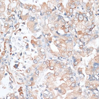 Polyclonal Rabbit anti-Human HMG-CoA Reductase / HMGCR Antibody (IHC, WB)