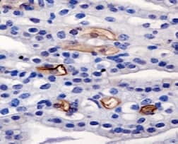 AGR2 Antibody (Internal)