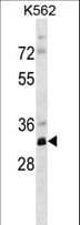 PRPS2 Antibody (aa77-106)
