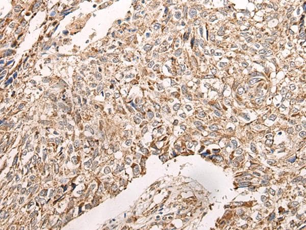 Polyclonal Rabbit anti-Human NDUFB11 Antibody (IHC, WB)