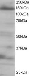 IHC-plus™ EIF4ENIF1 / 4E-T Antibody (aa974-986)