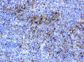 TP / Thymidine Phosphorylase Antibody (clone OTI1G10)