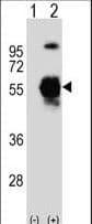 UBA3 / UBE1C Antibody (aa415-445)