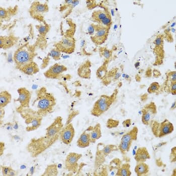 BTD / Biotinidase Antibody