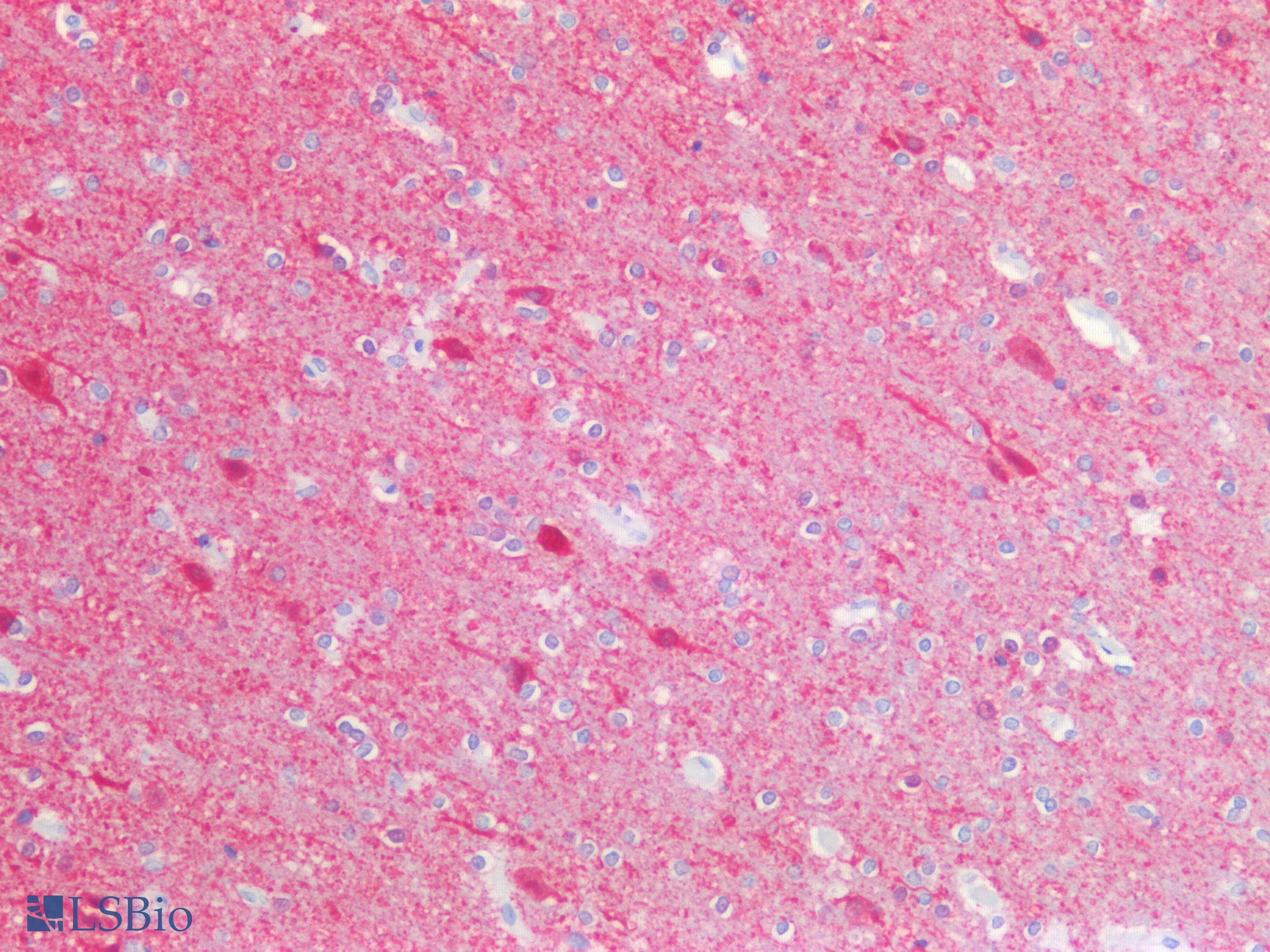 IHC-plus™ UCHL1 / PGP9.5 Antibody (C-Terminus)