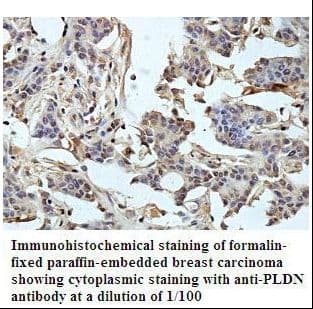 Polyclonal Rabbit anti-Human PLDN / Pallidin Antibody (aa1-172, IHC, WB)