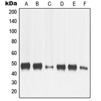 MMP13 Antibody (N-Terminus)
