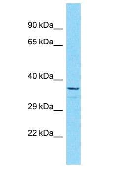 Polyclonal Rabbit anti-Human OR5B3 Antibody (aa261-310, WB)