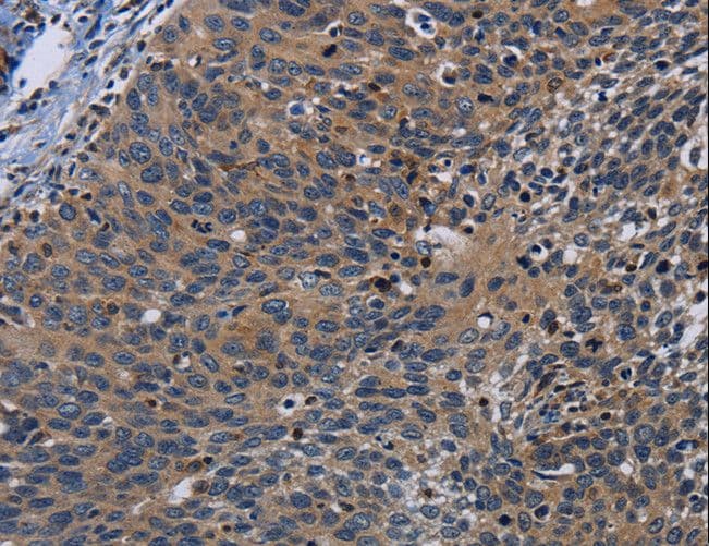 PCDHB15 Antibody