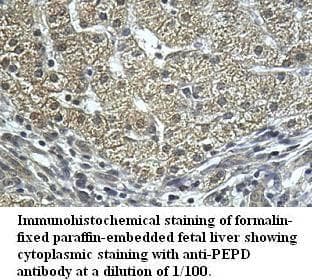 PEPD / PROLIDASE Antibody (aa22-290)