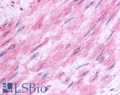 PathPlus™ HTR1B / 5-HT1B Receptor Antibody (Cytoplasmic Domain)