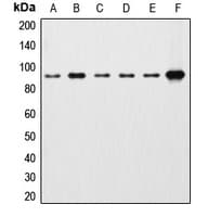 CTNNB1 / Beta Catenin Antibody (C-Terminus)