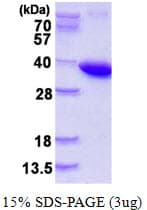 Human PPA1 Protein (Recombinant His)