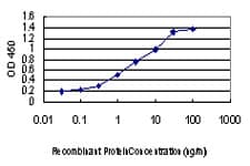 IHC-plus™ Monoclonal Mouse anti-Human CDKL1 Antibody (clone 2H6, IHC, WB)