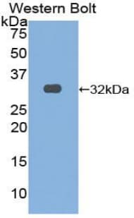 OSMR / IL-31R-Beta Antibody (aa503-749)