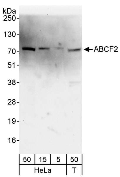 Polyclonal Rabbit anti-Human ABCF2 Antibody (aa573-623, IHC, WB)