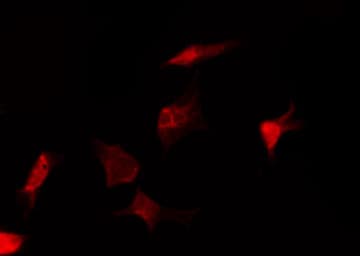 MAPK8 / JNK1 Antibody (phospho-Thr183,pTyr185)