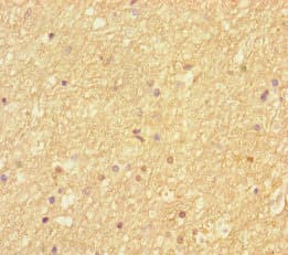 SEPT2 / Septin 2 Antibody