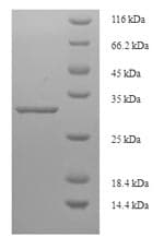 Human SEC11C Protein (Recombinant 6His-SUMO, N-terminus)