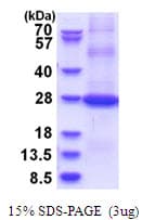 Human CD200 Protein (Recombinant His)