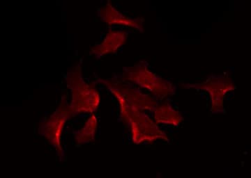 SYT13 Antibody