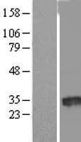 Human LOC388882 Protein (Over-Expression Lysate Myc-DDK (Flag))
