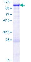 Human ZBED1 / TRAMP Protein (Recombinant GST)